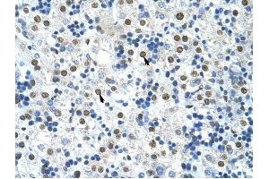 HNRPA0 antibody was used for immunohistochemistry at a concentration of 4-8 ug/ml to stain Hepatocytes (arrows) in Human Liver. (HNRNPA0 抗体  (Middle Region))