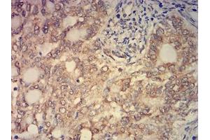 Immunohistochemistry (IHC) image for anti-K(lysine) Acetyltransferase 2B (KAT2B) (AA 1-142) antibody (ABIN7193343)