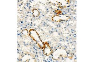 Immunohistochemistry of paraffin embedded mouse kidney using Cdcp1 (ABIN7073600) at dilution of 1:300 (400x lens) (CDCP1 抗体)