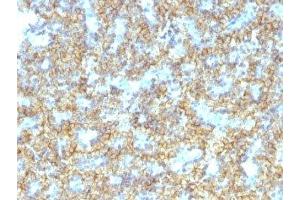 Formalin-fixed, paraffin-embedded human parathyroid stained with PTH antibody (PTH/1174). (PTH 抗体  (AA 32-115))