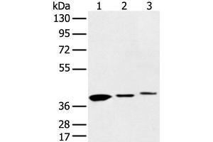 Western blot analysis of 231 cell Human fetal liver and Human fetal brain tissue using MAT2B Polyclonal Antibody at dilution of 1:500 (MAT2B 抗体)
