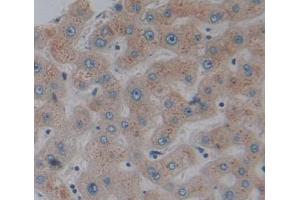 Used in DAB staining on fromalin fixed paraffin- embedded liver tissue (GCDH 抗体  (AA 270-438))