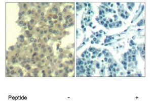 Image no. 1 for anti-Receptor Tyrosine-Protein Kinase ErbB-3 (ERBB3) (AA 1326-1330) antibody (ABIN319384) (ERBB3 抗体  (AA 1326-1330))