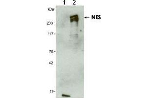 Detection of human NES using NES monoclonal antibody, clone 10C2 . (Nestin 抗体  (AA 1464-1614))