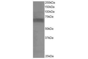 Image no. 1 for anti-Ribosomal Protein S6 Kinase, 70kDa, Polypeptide 1 (RPS6KB1) (C-Term) antibody (ABIN374267) (RPS6KB1 抗体  (C-Term))