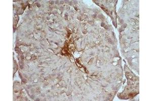 Mouse testis tissue was stained by Rabbit Anti-Desnutrin (465-486) (Mouse) Serum (PNPLA2 抗体  (AA 465-486))