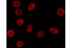 ABIN6275740 staining Hela by IF/ICC. (MNT 抗体  (Internal Region))