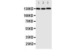 Western Blotting (WB) image for anti-Cadherin 5 (CDH5) (AA 766-784), (C-Term) antibody (ABIN3042913) (Cadherin 5 抗体  (C-Term))