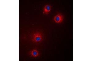 Immunofluorescent analysis of GPR18 staining in Jurkat cells. (GPR18 抗体  (Center))