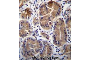 SYPL1 Antibody (N-term) immunohistochemistry analysis in formalin fixed and paraffin embedded human stomach tissue followed by peroxidase conjugation of the secondary antibody and DAB staining. (SYPL1 抗体  (N-Term))
