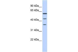 WB Suggested Anti-PHF23 Antibody Titration:  0. (PHF23 抗体  (N-Term))