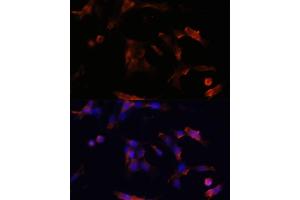 Immunofluorescence analysis of NIH/3T3 cells using  antibody (ABIN6133586, ABIN6137050, ABIN6137052 and ABIN6225252) at dilution of 1:100. (Aquaporin 5 抗体  (AA 150-250))