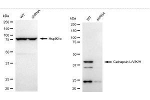 Western blotting analysis using Cathepsin L/V/K/H antibody (ABIN7797941).