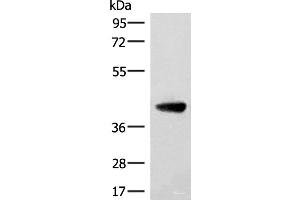 ST8SIA4 抗体