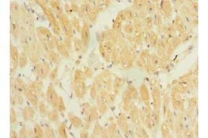 Immunohistochemistry of paraffin-embedded human heart tissue using ABIN7172320 at dilution of 1:100 (TP53TG5 抗体  (AA 1-290))