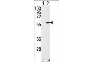 Western blot analysis of STK4 (arrow) using MST1 Antibody (C-term) (ABIN392427 and ABIN2842030). (MST1 抗体  (C-Term))