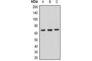 Western blot analysis of XPV expression in Hela (A), HepG2 (B), Raji (C) whole cell lysates. (POLH 抗体)