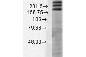 Western Blot analysis of Rat brain membrane lysate showing detection of SHANK1 protein using Mouse Anti-SHANK1 Monoclonal Antibody, Clone S22-21 . (SHANK1 抗体  (AA 469-691) (Biotin))