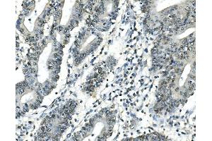 IHC analysis of ATF1 using anti-ATF1 antibody (ABIN7599192). (AFT1 抗体  (AA 1-271))