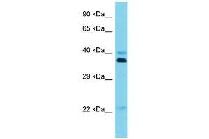 Host: Rabbit Target Name: OR5I1 Sample Type: Jurkat Whole Cell lysates Antibody Dilution: 1. (OR5I1 抗体  (C-Term))