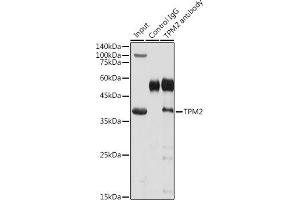 Immunoprecipitation analysis of 300 μg extracts of Mouse skeletal muscle cells using 3 μg TPM2 antibody (ABIN3017364, ABIN3017365, ABIN3017366 and ABIN6220054). (TPM2 抗体)