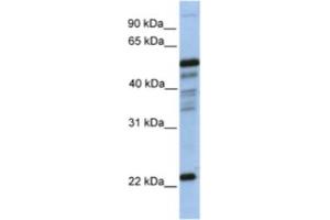 Western Blotting (WB) image for anti-Prostaglandin D2 Synthase (PTGDS) antibody (ABIN2463214) (PTGDS 抗体)