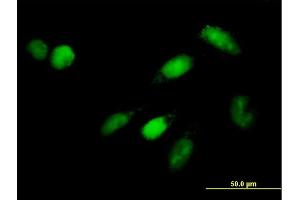 Immunofluorescence of purified MaxPab antibody to ISGF3G on HeLa cell. (IRF9 抗体  (AA 1-393))