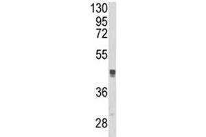 Western blot analysis of TGN46 antibody and MCF-7 lysate. (TGOLN2 抗体  (AA 399-427))