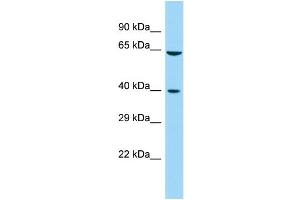 Host: Rabbit Target Name: FAM172A Sample Type: Fetal Kidney lysates Antibody Dilution: 1. (Fam172a 抗体  (Middle Region))