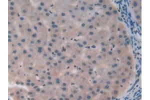 Immunohistochemistry (IHC) image for anti-Secretoglobin, Family 1A, Member 1 (Uteroglobin) (SCGB1A1) (AA 23-91) antibody (ABIN7432760)