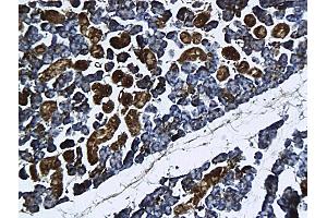 Formalin-fixed and paraffin embedded rat submandibular gland labeled with Anti-GnRHR Polyclonal Antibody, Unconjugated followed by conjugation to the secondary antibody and DAB staining (GNRHR 抗体  (AA 201-328))