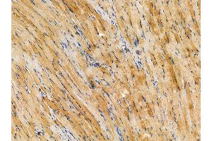 ABIN7094999 and ABIN7099055 at 1/100 staining rat muscle tissue by IHC-P.