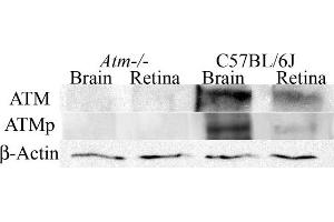 Determination of ATM and ATMp antibodies specificity by western blotting. (ATM 抗体  (AA 1974-1988))