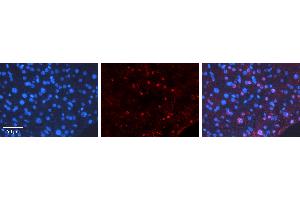 Rabbit Anti-CEBPD Antibody   Formalin Fixed Paraffin Embedded Tissue: Human Liver Tissue Observed Staining: Nucleus Primary Antibody Concentration: 1:100 Other Working Concentrations: N/A Secondary Antibody: Donkey anti-Rabbit-Cy3 Secondary Antibody Concentration: 1:200 Magnification: 20X Exposure Time: 0. (CEBPD 抗体  (Middle Region))