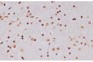 Immunohistochemistry (Paraffin-embedded Sections) (IHC (p)) image for anti-Histone 3 (H3) (acLys14), (acLys18), (acLys23), (acLys27), (acLys9) antibody (ABIN7259751)
