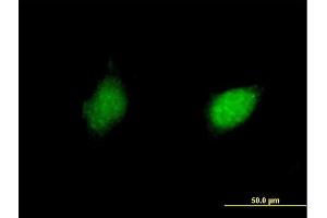 Immunofluorescence of purified MaxPab antibody to RXRG on HeLa cell. (Retinoid X Receptor gamma 抗体  (AA 1-463))