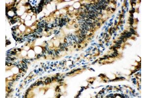 Anti-Egr1 antibody, IHC(P) IHC(P): Rat Intestine Tissue (EGR1 抗体  (N-Term))