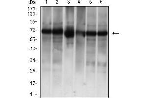 Western Blotting (WB) image for anti-Albumin (ALB) (AA 410-609) antibody (ABIN7193632)