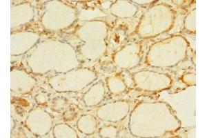 Immunohistochemistry of paraffin-embedded human thyroid tissue using ABIN7174896 at dilution of 1:100 (C8orf34 抗体  (AA 1-300))