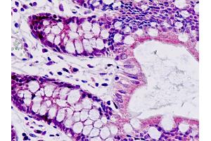 Anti-SAR1A / SAR1 antibody IHC staining of human small intestine. (SAR1A 抗体  (AA 128-158))