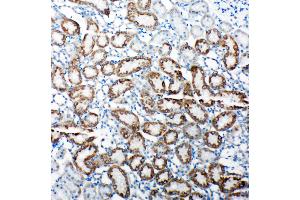 Anti-TRAM1 antibody, IHC(P) IHC(P): Rat Kidney Tissue (TRAM1 抗体  (C-Term))