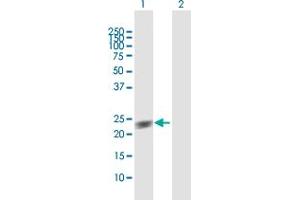 Western Blot analysis of GUK1 expression in transfected 293T cell line by GUK1 MaxPab polyclonal antibody. (GUK1 抗体  (AA 1-197))