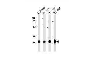 Western Blotting (WB) image for anti-Succinate Dehydrogenase Complex, Subunit B, Iron Sulfur (Ip) (SDHB) (AA 147-182) antibody (ABIN6243638)