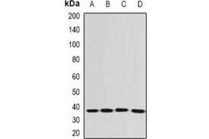 Western blot analysis of EEF1D expression in SHSY5Y (A), Jurkat (B), A549 (C), mouse spleen (D) whole cell lysates. (EEF1D 抗体)