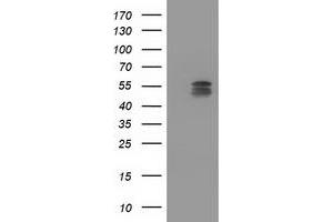 Western Blotting (WB) image for anti-Cytochrome P450, Family 2, Subfamily C, Polypeptide 9 (CYP2C9) antibody (ABIN1497726) (CYP2C9 抗体)