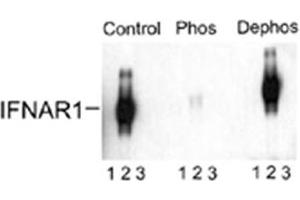 Western blot of immunoprecipitates from HEK 293 cells transfected with 1. (IFNAR1 抗体  (pSer535, pSer539))