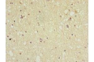 Immunohistochemistry of paraffin-embedded human brain tissue using ABIN7169258 at dilution of 1:100