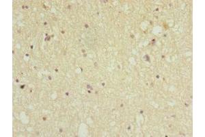 Immunohistochemistry of paraffin-embedded human brain tissue using ABIN7169258 at dilution of 1:100 (PPP2R5C 抗体  (Regulatory Subunit Gamma))