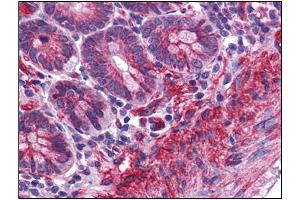 Human Small Intestine: Formalin-Fixed, Paraffin-Embedded (FFPE) (MTCH2 抗体  (N-Term))