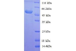 Lysophospholipase I (LYPLA1) (AA 1-230), (full length) protein (GST tag)